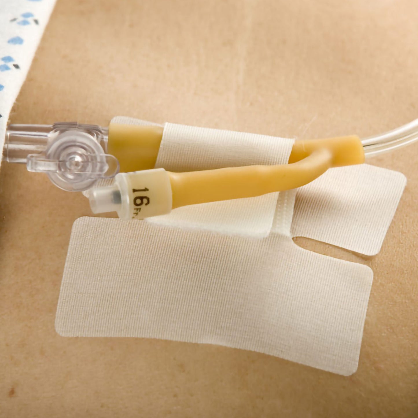 Cath Secure® Extended Tab Tube Holder