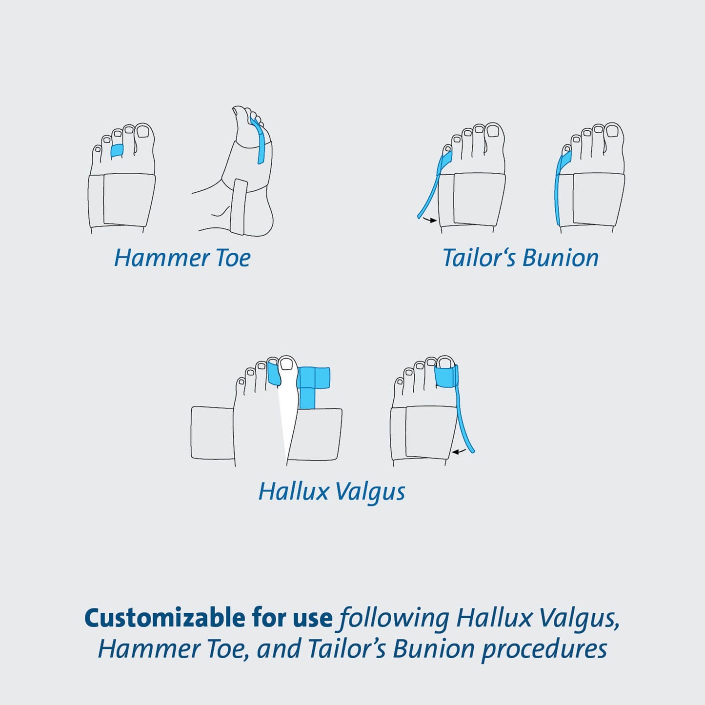 TAS™ Toe Splint, One Size Fits Most