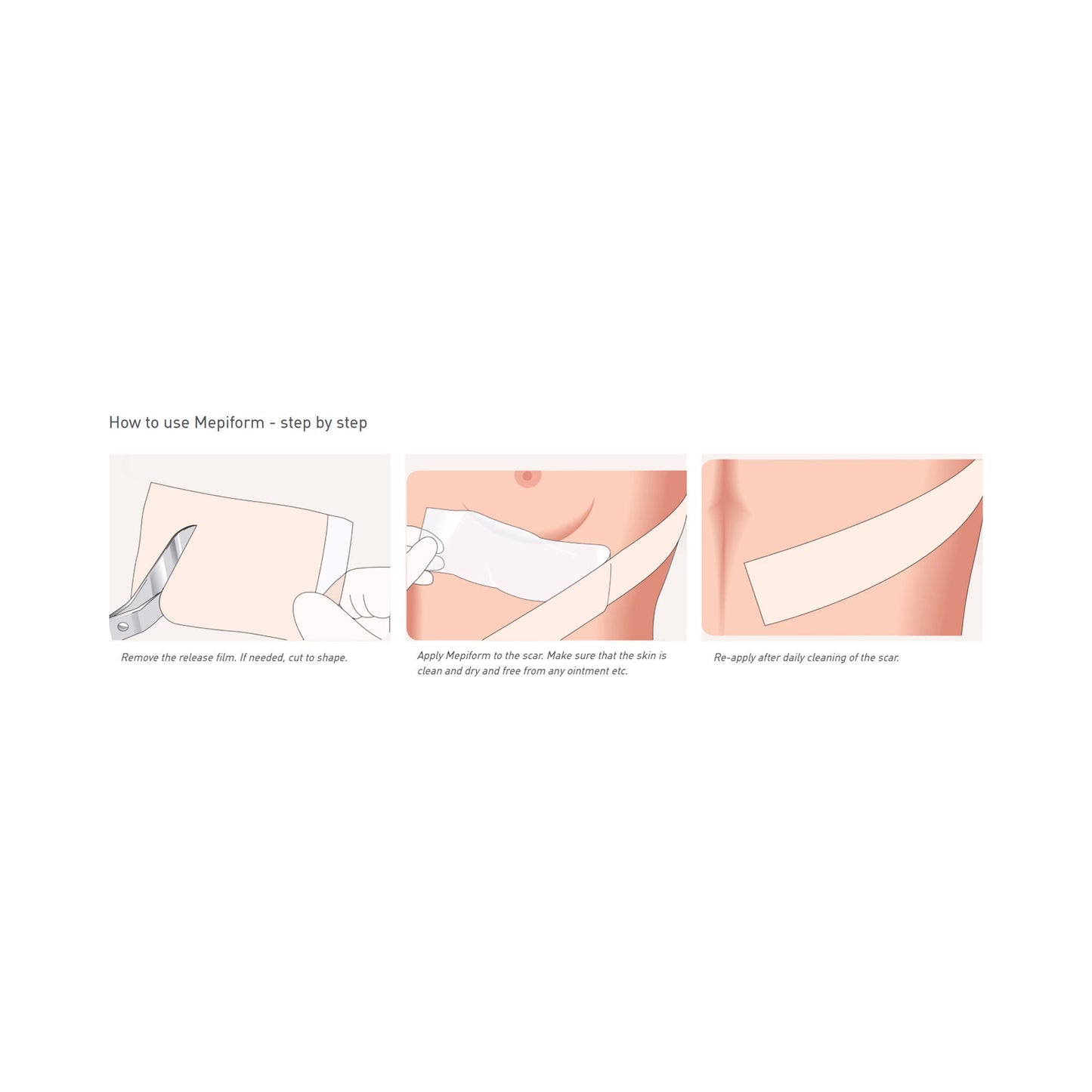 Mepiform® Self Adherent Silicone Dressing, 2 x 3 Inch