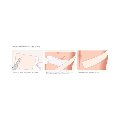 Mepiform® Self Adherent Silicone Dressing, 2 x 3 Inch
