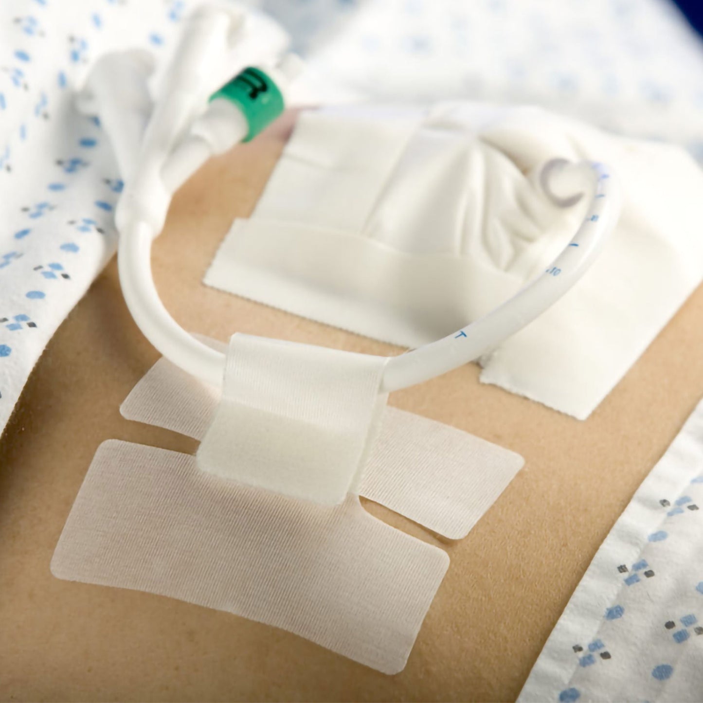 Cath Secure® Extended Tab Tube Holder